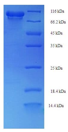 Human Phosphoenolpyruvate Synthase Protein (Recombinant His-SUMO)