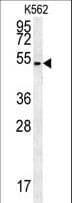 Polyclonal Rabbit anti-Human Skn / HHAT Antibody (aa30-59, IHC, WB)