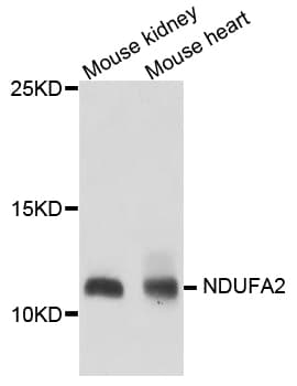 Polyclonal Rabbit anti-Human NDUFA2 Antibody (IHC, WB)