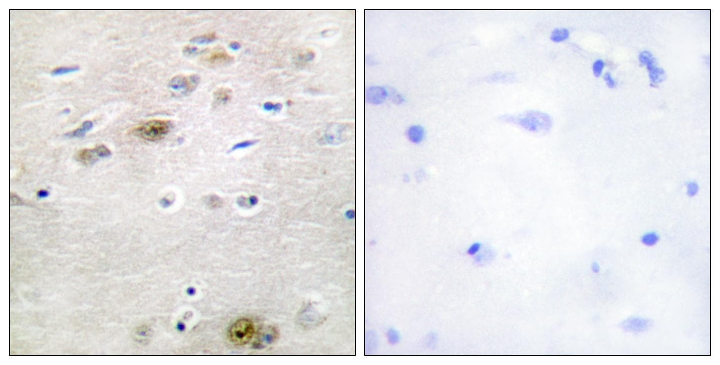 Polyclonal Rabbit anti-Human TRA2A Antibody (IHC, IF, WB)