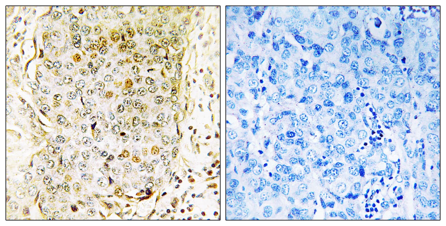 MAP3K11 / MLK3 Antibody (aa640-689)