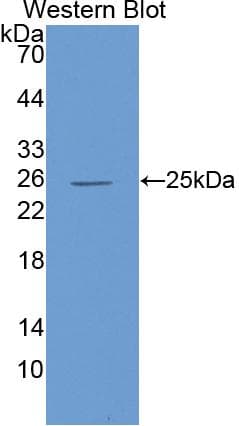 IL6 / Interleukin 6 Antibody (aa27-212, APC)