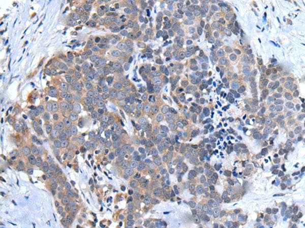 Ubiquilin 2 / UBQLN2 Antibody