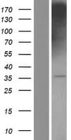 Human TSPAN32 / PHEMX Protein (Over-Expression Lysate Myc-DDK (Flag))