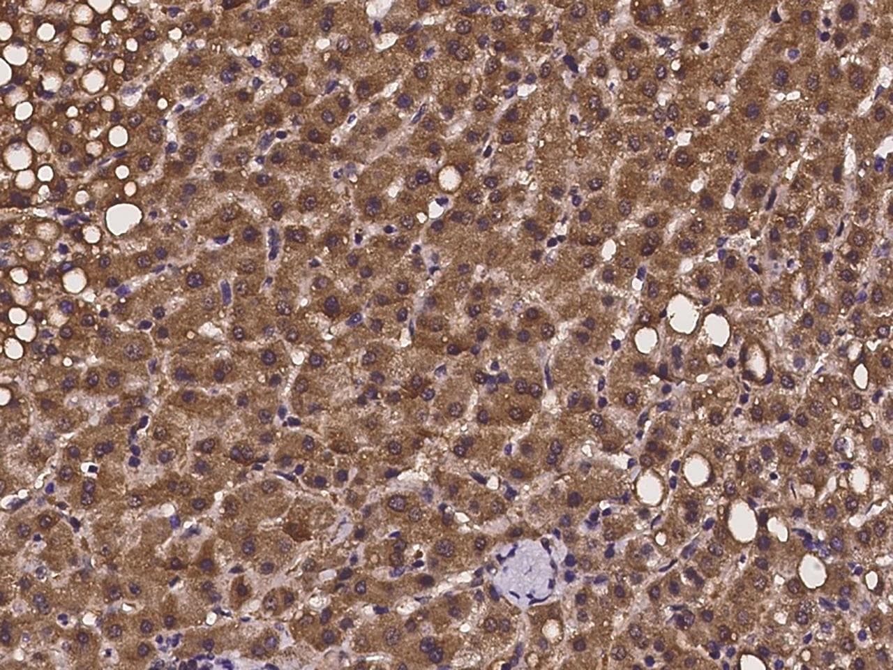 PEX13 Antibody