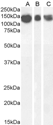 APP / Beta Amyloid Precursor Antibody (Amyloid Beta, clone 6E10)
