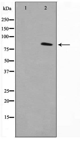 TACC1 Antibody