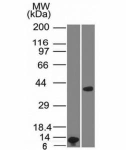 ARG1 / Arginase 1 Antibody (aa1-150, clone ARG1/1125)