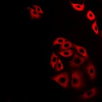 Polyclonal Rabbit anti-Human KIAA0652 / ATG13 Antibody (IF, WB)