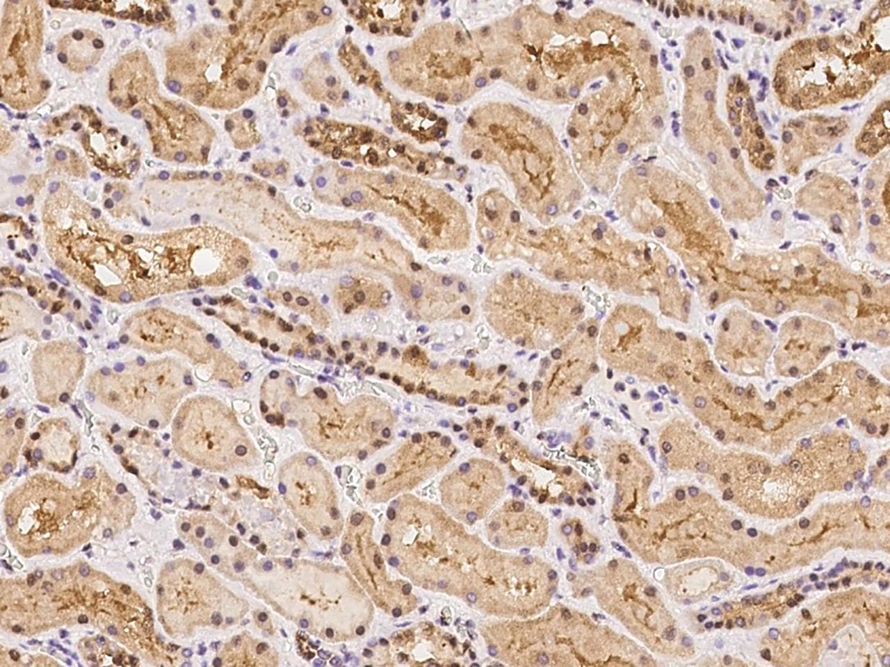 POLR3H Antibody