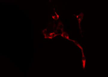 Polyclonal Rabbit anti-Human URI1 / NNX3 Antibody (IHC, IF, WB)