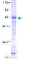 Human HSU79274 / C12orf24 Protein (Recombinant GST)