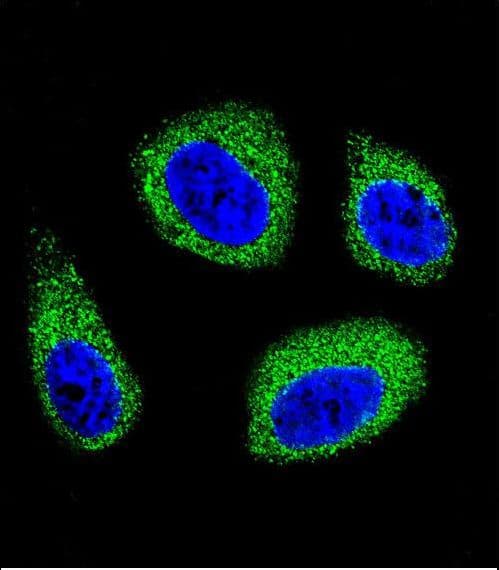 DHCR7 Antibody (aa437-463)