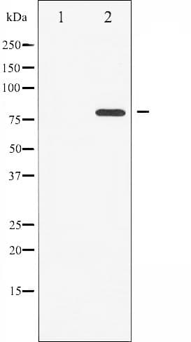 ATRIP Antibody (phospho-Ser68)