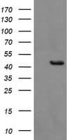 Monoclonal Mouse anti-Human BBOX1 / BBOX Antibody (clone OTI8B12, IHC, WB)