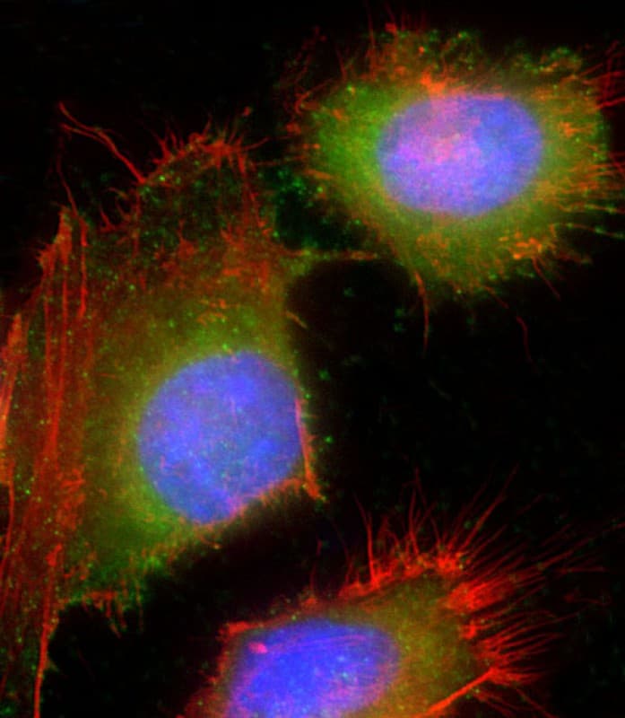 Polyclonal Rabbit anti-Human HSD17B10 / HADH2 Antibody (Internal, IHC, IF, WB)