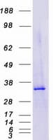 Human PARP16 Protein (Recombinant Myc-DDK (Flag))