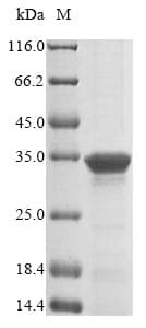 Mycoplasma pneumoniae MPN_372 Protein (Recombinant 10His, N-terminus + Myc, C-terminus)