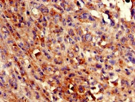 ADCK4 Antibody