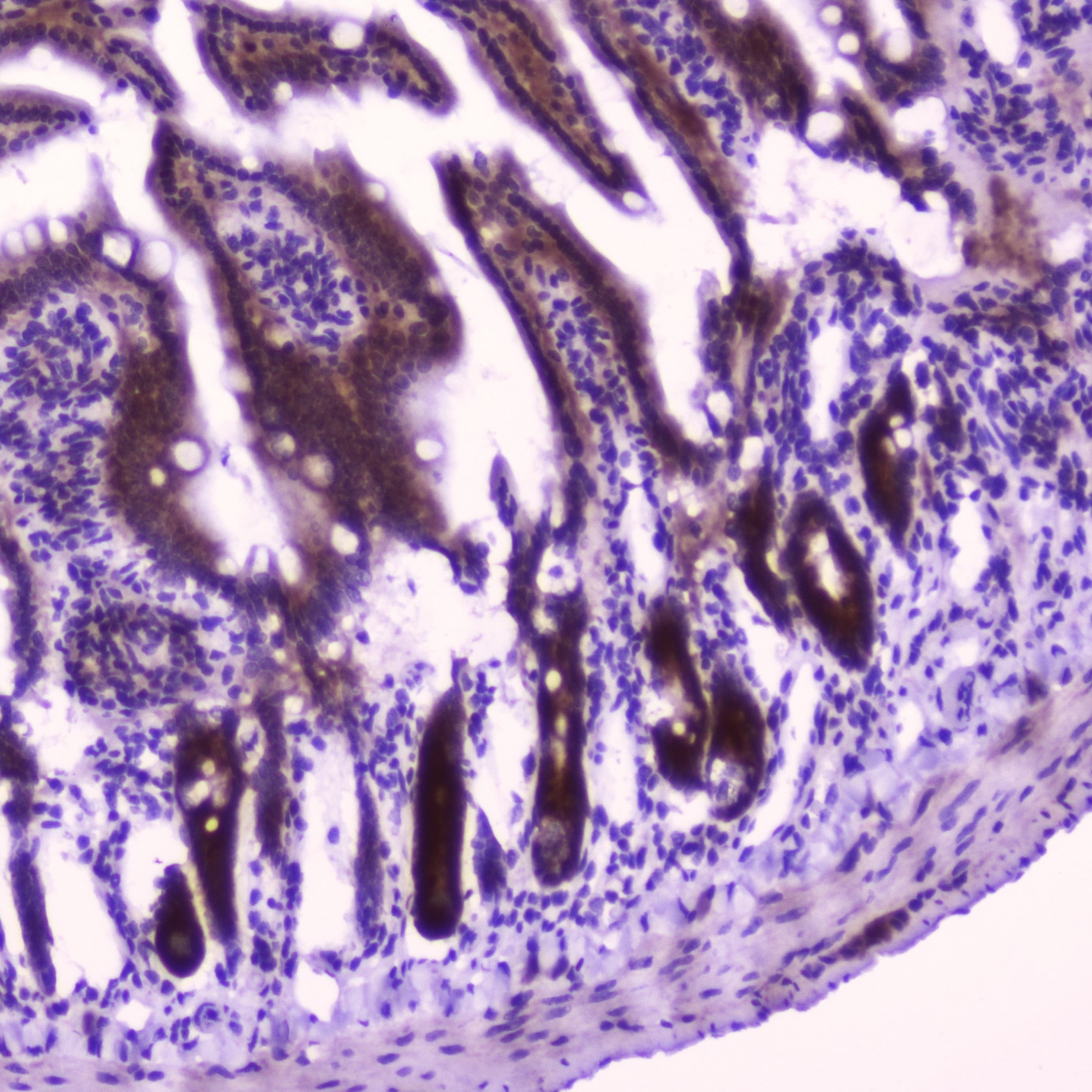 CFLAR / FLIP Antibody