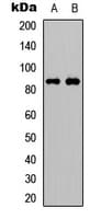 Polyclonal Rabbit anti-Human FRS2 Antibody (C-Terminus, IHC, WB)