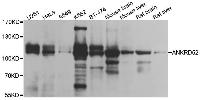 IHC-plus™ ANKRD52 Antibody