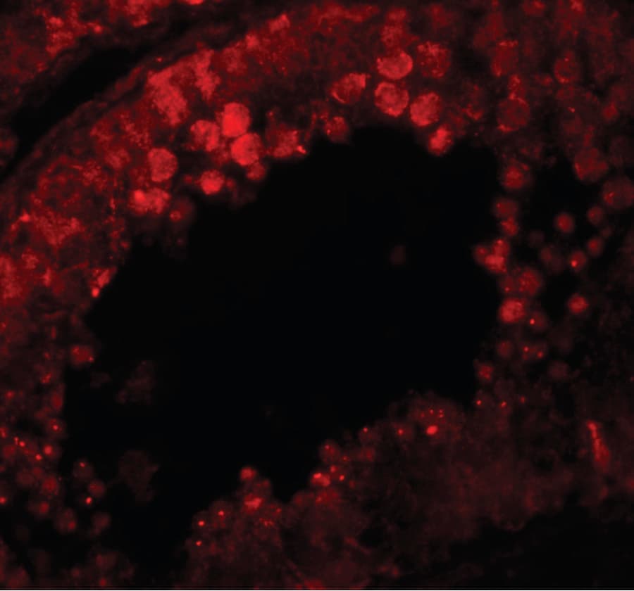 IHC-plus™ CRISP2 / TSP1 Antibody