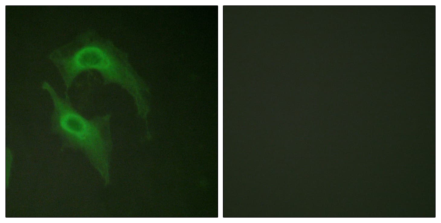 Polyclonal Rabbit anti-Human DNAM-1 / CD226 Antibody (aa287-336, IF, WB)