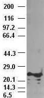 NOG / Noggin Antibody (clone OTI4C12)