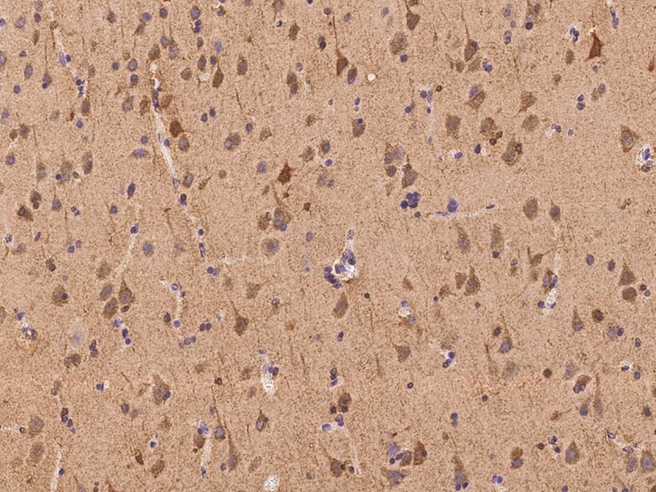 KIAA1674 / LRRC27 Antibody