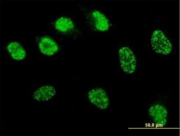 MSH6 Antibody (clone 1F2)