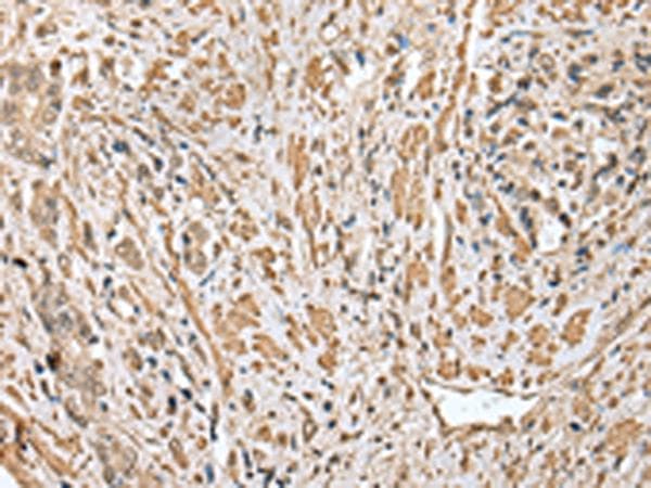Cnpy2 / TMEM4 Antibody