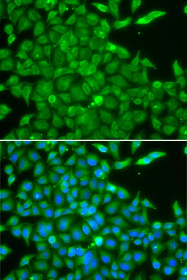 Polyclonal Rabbit anti-Human CSNK1G2 / CKI-Gamma 2 Antibody (IHC, IF, WB)