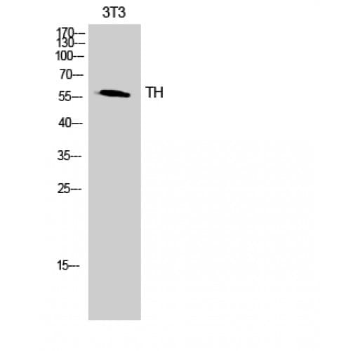 Polyclonal Rabbit anti-Human TH / Tyrosine Hydroxylase Antibody (10-90 aa, IHC, IF, WB)