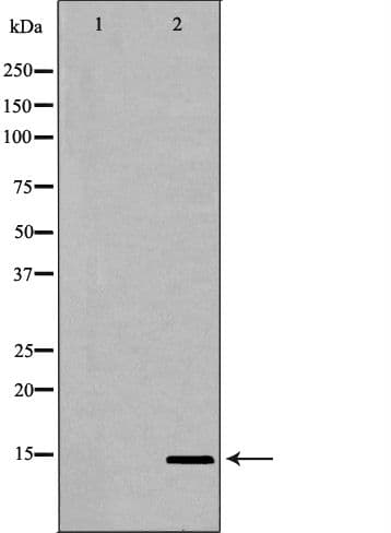 UTS2 / Urotensin II Antibody