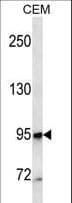 MME / CD10 Antibody (aa272-300)