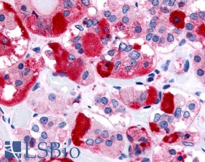 PathPlus™ TRH Receptor / TRHR Antibody (C-Terminus)