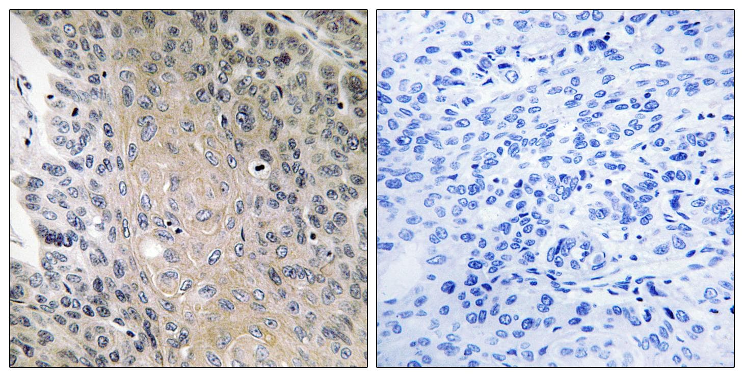 Polyclonal Rabbit anti-Human RAB41 Antibody (IHC)