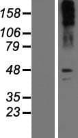 SLC6A2 / NET Protein (Over-Expression Lysate Myc-DDK (Flag))