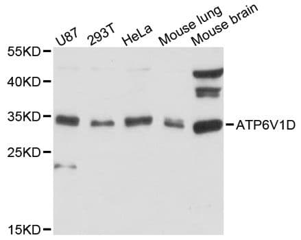 ATP6V1D / V-ATPase subunit D Antibody