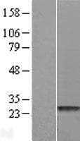 HDHD1 Protein (Over-Expression Lysate Myc-DDK (Flag))