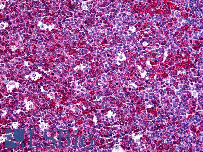 IHC-plus™ CXCL5 Antibody (clone 2A9)