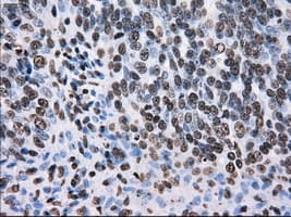 KIAA0153 / TTLL12 Antibody (clone OTI4B2)