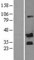 CRH / CRF Protein (Over-Expression Lysate Myc-DDK (Flag))