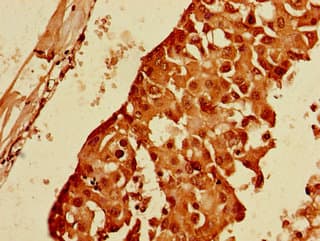 PPP1R13B Antibody