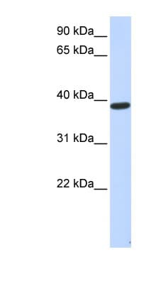 Polyclonal Rabbit anti-Human PPP1R7 Antibody (aa107-156, WB)