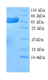 Mouse HMGCS1 / HMG-CoA Synthase 1 Protein (Recombinant His)