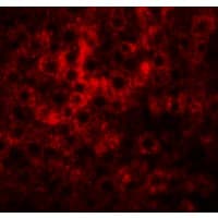 IHC-plus™ Polyclonal Rabbit anti-Human HDGFRP2 Antibody (IHC, IF, WB)