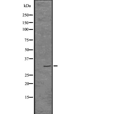 Polyclonal Rabbit anti-Human PDCD1 / CD279 / PD-1 Antibody (IHC, WB)