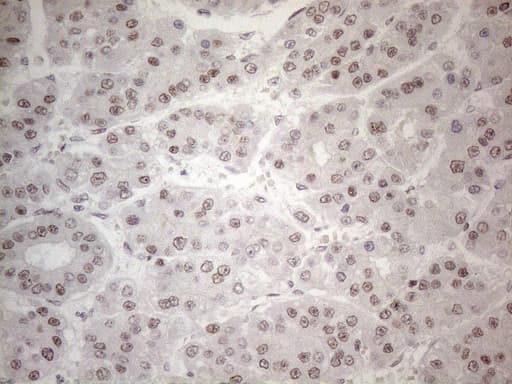 IRS1 Antibody (aa1-280, clone OTI2B10)